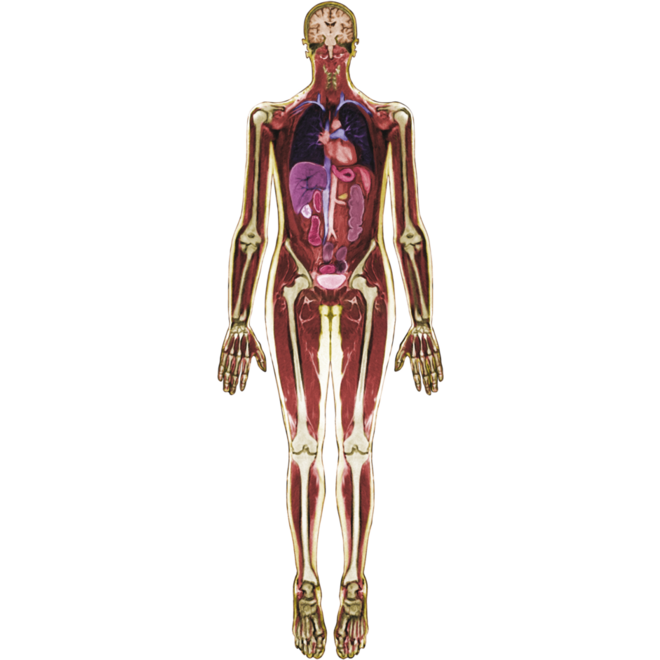 MRI-scan lichaam